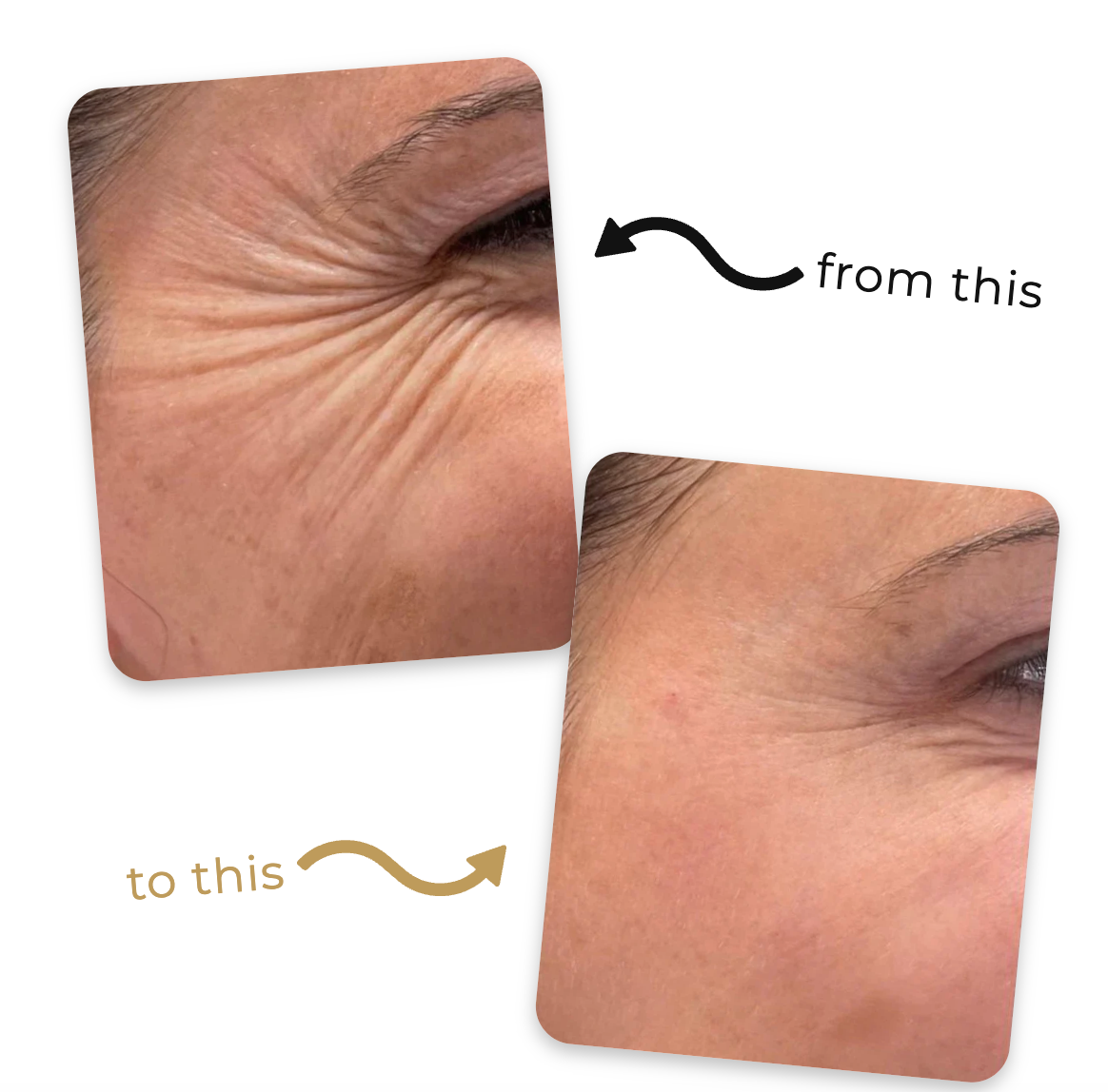 Gold Silk Lifting Peptide